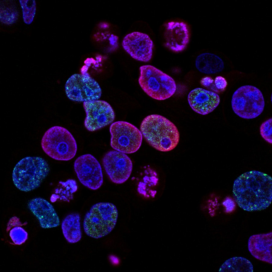 BPC-157 tendon-to-bone healing — cartilage repair histology